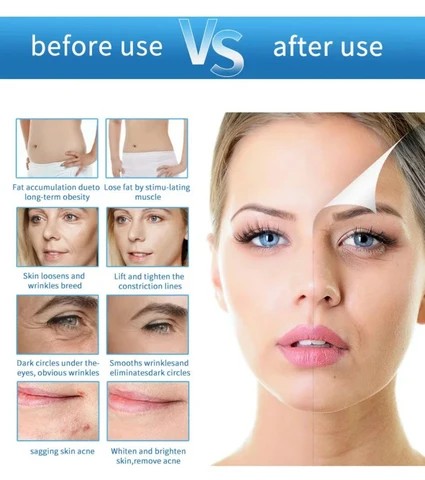 White BG Image 9