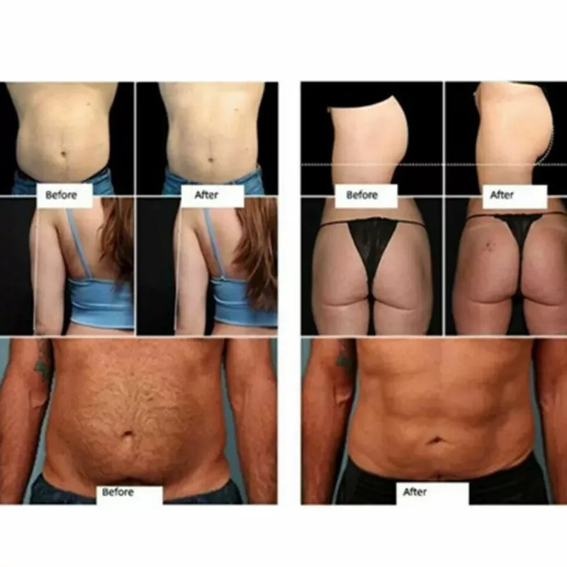S0031